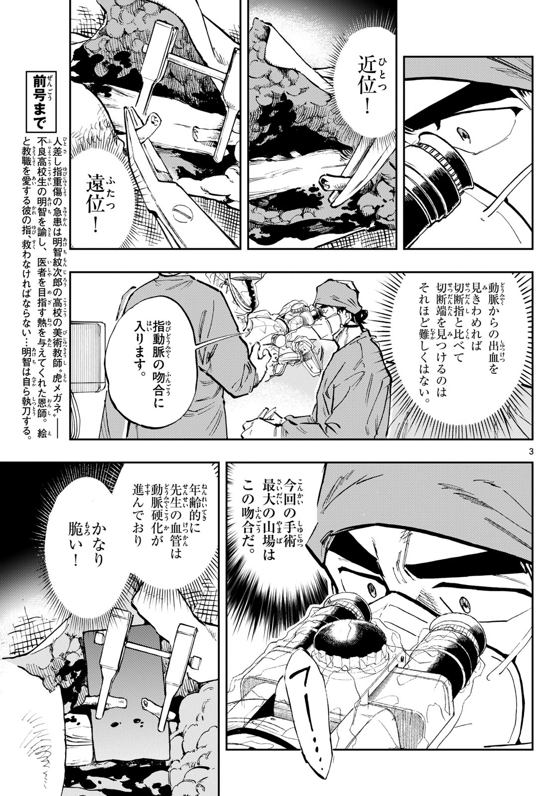 テノゲカ 第28話 - Page 3